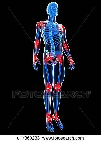 Joint pain, conceptual computer artwork. View Large Photo Image Stock Image - Joint pain, conceptual computer artwork.. Fotosearch