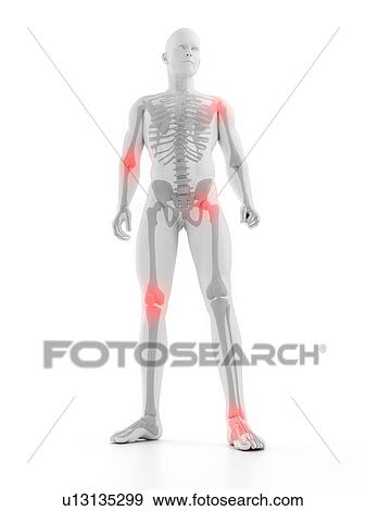 Joint pain, conceptual computer artwork. View Large Photo Image Stock Photo - Joint pain, conceptual computer artwork.. Fotosearch