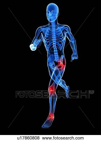 Stock Photo - Joint pain, conceptual computer artwork.. Fotosearch