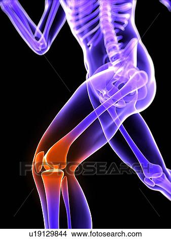 Knee pain, conceptual computer artwork. View Large Photo Image Picture - Knee pain, conceptual computer artwork.. Fotosearch