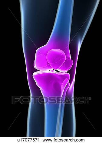 Knee pain, conceptual computer artwork. View Large Photo Image Stock Image - Knee pain, conceptual computer artwork.. Fotosearch