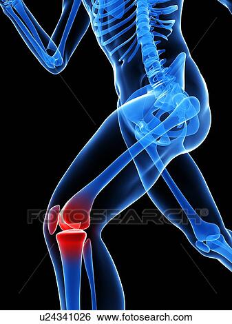 Stock Photograph - Knee pain, conceptual computer artwork.. Fotosearch