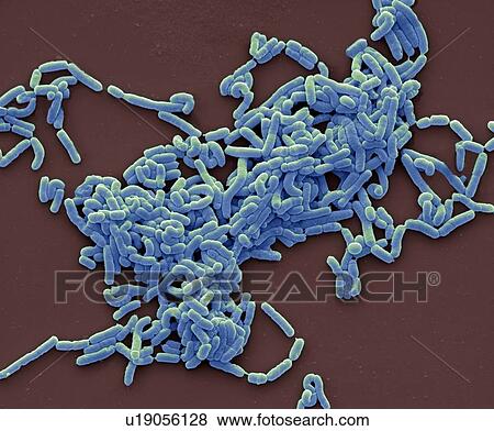 Lactobacillus casei bacteria, coloured scanning electron micrograph (SEM). Magnification: x3000 when printed at 10 centimetres wide. View Large Photo Image Stock Photo - Lactobacillus casei bacteria, coloured scanning electron micrograph (SEM). Magnification: x3000 when printed at 10 centimetres wide.. Fotosearch