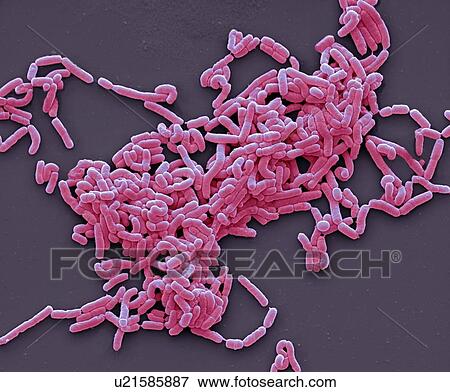 Stock Photo - Lactobacillus casei bacteria, coloured scanning electron micrograph (SEM). Magnification: x3000 when printed at 10 centimetres wide.. Fotosearch