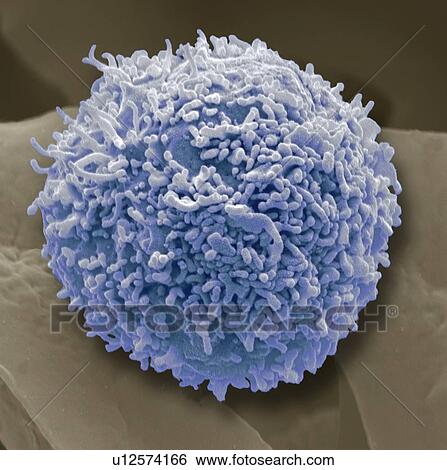 Lymphocyte white blood cell, coloured scanning electron micrograph (SEM). Its surface is covered in characteristic microvilli. Magnification: x6000 when printed at 10 centimetres wide. View Large Photo Image Stock Photograph - Lymphocyte white blood cell, coloured scanning electron micrograph (SEM). Its surface is covered in characteristic microvilli. Magnification: x6000 when printed at 10 centimetres wide.. Fotosearch