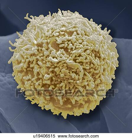 Stock Photography - Lymphocyte white blood cell, coloured scanning electron micrograph (SEM). Its surface is covered in characteristic microvilli. Magnification: x6000 when printed at 10 centimetres wide.. Fotosearch