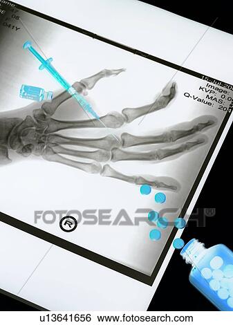 Medical treatment, conceptual image. View Large Photo Image Stock Photograph - Medical treatment, conceptual image.. Fotosearch