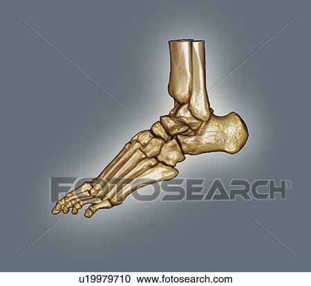 Normal foot. Coloured 3D computed tomography (CT) scan of the healthy foot of a 23 year old patient. View Large Photo Image Stock Image - Normal foot. Coloured 3D computed tomography (CT) scan of the healthy foot of a 23 year old patient.. Fotosearch
