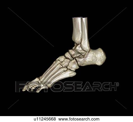Stock Photo - Normal foot. Coloured 3D computed tomography (CT) scan of the healthy foot of a 23 year old patient.. Fotosearch