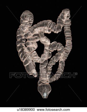 Normal intestines. Coloured 3D computed tomography (CT) scan of the healthy intestines of 38 year old patient. View Large Photo Image Stock Image - Normal intestines. Coloured 3D computed tomography (CT) scan of the healthy intestines of 38 year old patient.. Fotosearch
