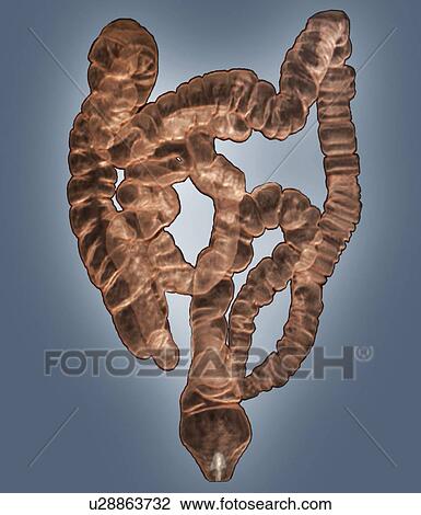 Normal intestines. Coloured 3D computed tomography (CT) scan of the healthy intestines of 38 year old patient. View Large Photo Image Stock Image - Normal intestines. Coloured 3D computed tomography (CT) scan of the healthy intestines of 38 year old patient.. Fotosearch