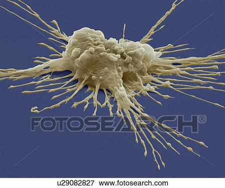 Pluripotent stem cell. Coloured scanning electron micrograph (SEM) of a pluripotent stem cell derived from a macrophage white blood cell. Magnification: x4000 when printed at 10 centimetres wide. View Large Photo Image Stock Photo - Pluripotent stem cell. Coloured scanning electron micrograph (SEM) of a pluripotent stem cell derived from a macrophage white blood cell. Magnification: x4000 when printed at 10 centimetres wide.. Fotosearch