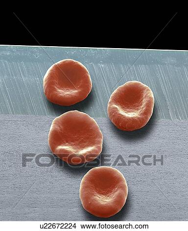 Red blood cells. Coloured scanning electron micrograph (SEM) of red blood cells (erythrocytes) on a razor blade. Magnification: x3, 700 when printed at 10 centimetres tall. View Large Photo Image Picture - Red blood cells. Coloured scanning electron micrograph (SEM) of red blood cells (erythrocytes) on a razor blade. Magnification: x3, 700 when printed at 10 centimetres tall.. Fotosearch