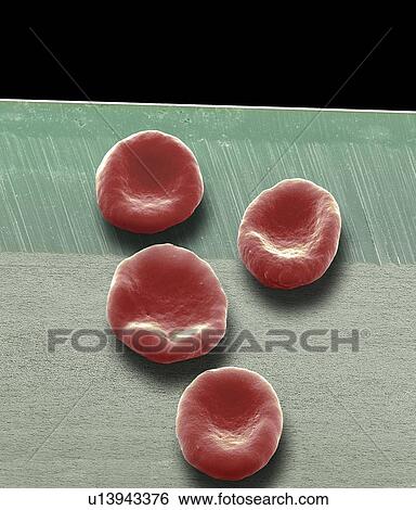 Red blood cells. Coloured scanning electron micrograph (SEM) of red blood cells (erythrocytes) on a razor blade. Magnification: x3, 700 when printed at 10 centimetres tall. View Large Photo Image Stock Photograph - Red blood cells. Coloured scanning electron micrograph (SEM) of red blood cells (erythrocytes) on a razor blade. Magnification: x3, 700 when printed at 10 centimetres tall.. Fotosearch