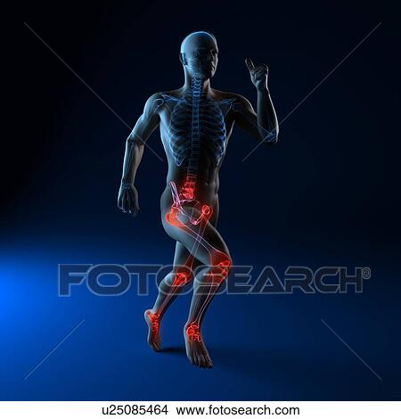Picture - Running injuries, conceptual computer artwork.. Fotosearch