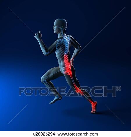 Picture - Running injuries, conceptual computer artwork.. Fotosearch
