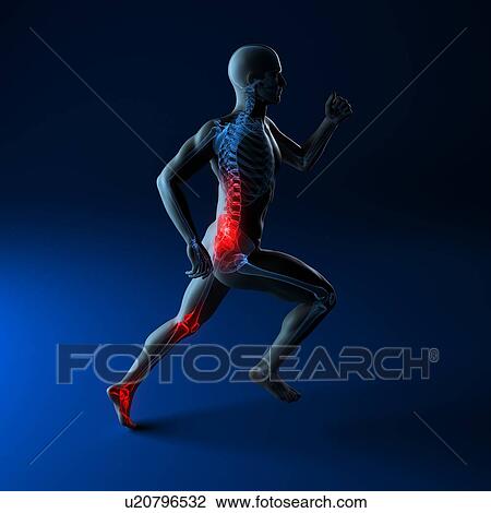 Stock Image - Running injuries, conceptual computer artwork.. Fotosearch