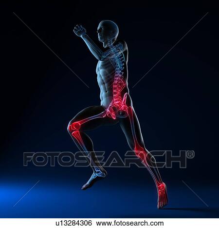 Running injuries, conceptual computer artwork. View Large Photo Image Stock Photograph - Running injuries, conceptual computer artwork.. Fotosearch