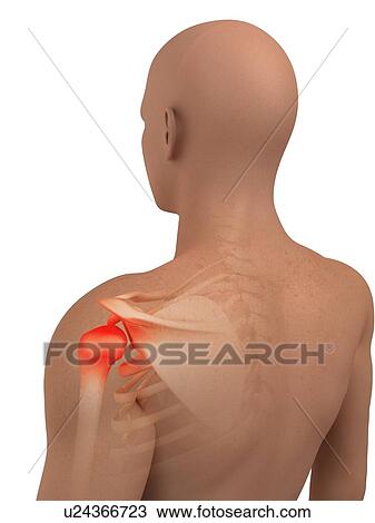 Shoulder pain, conceptual computer artwork. View Large Photo Image Stock Image - Shoulder pain, conceptual computer artwork.. Fotosearch