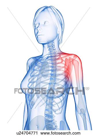 Shoulder pain, conceptual computer artwork. View Large Photo Image Stock Image - Shoulder pain, conceptual computer artwork.. Fotosearch