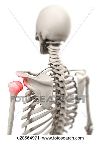 Stock Image - Shoulder pain, conceptual computer artwork.. Fotosearch
