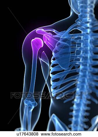 Stock Photo - Shoulder pain, conceptual computer artwork.. Fotosearch
