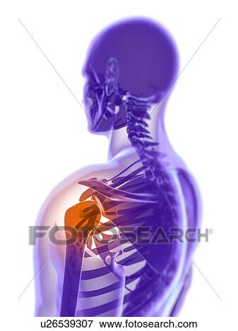 Stock Photo - Shoulder pain, conceptual computer artwork.. Fotosearch