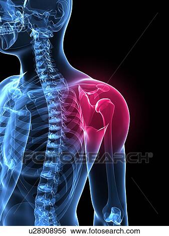 Stock Photograph - Shoulder pain, conceptual computer artwork.. Fotosearch
