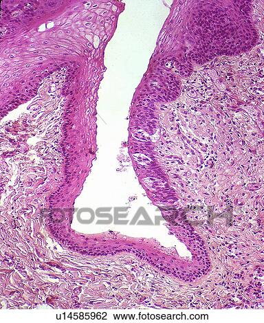 Taste buds. Light micrograph of a section through a tongue showing tastebuds (lighter purple areas to the right of the white indent). View Large Photo Image Stock Image - Taste buds. Light micrograph of a section through a tongue showing tastebuds (lighter purple areas to the right of the white indent).. Fotosearch