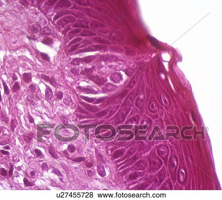 Taste buds Light micrograph of a section through a tongue showing a tastebud (upper centre). View Large Photo Image Stock Photo - Taste buds Light micrograph of a section through a tongue showing a tastebud (upper centre).. Fotosearch