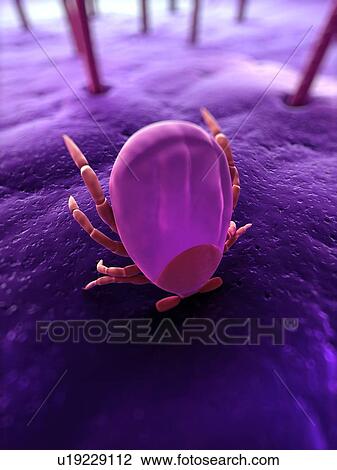 Stock Image - Tick. Computer artwork of a tick (superfamily Ixodoidea) biting skin.. Fotosearch