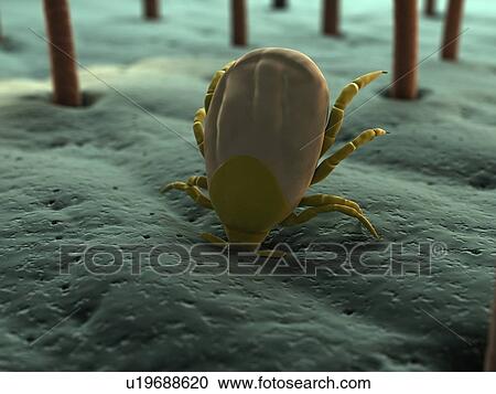 Tick. Computer artwork of a tick (superfamily Ixodoidea) biting skin. View Large Photo Image Stock Image - Tick. Computer artwork of a tick (superfamily Ixodoidea) biting skin.. Fotosearch