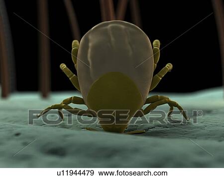 Tick. Computer artwork of a tick (superfamily Ixodoidea) biting skin. View Large Photo Image Stock Photo - Tick. Computer artwork of a tick (superfamily Ixodoidea) biting skin.. Fotosearch