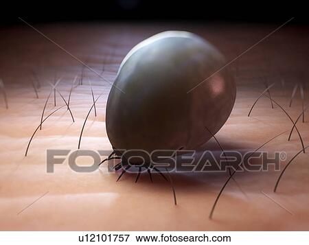 Stock Photo - Tick. Computer artwork of a tick (superfamily Ixodoidea) feeding.. Fotosearch