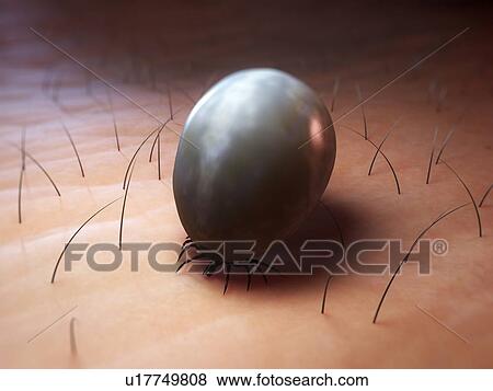 Stock Photo - Tick. Computer artwork of a tick (superfamily Ixodoidea) feeding.. Fotosearch