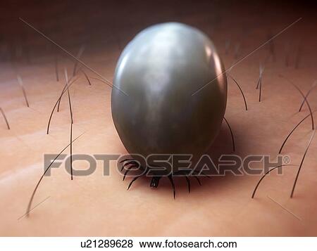 Tick. Computer artwork of a tick (superfamily Ixodoidea) feeding. View Large Photo Image Stock Photo - Tick. Computer artwork of a tick (superfamily Ixodoidea) feeding.. Fotosearch