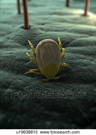 Stock Photography - Tick. Computer artwork of a tick (superfamily Ixodoidea) biting skin.. Fotosearch