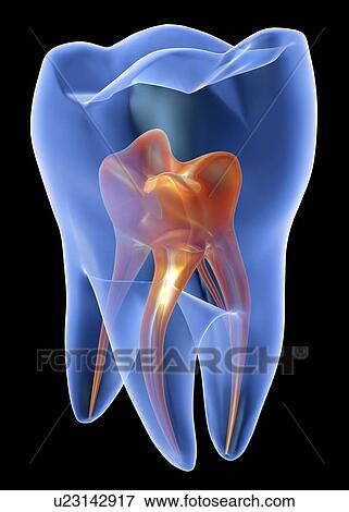 Stock Photo - Tooth, transparent cross section of a molar tooth showing the pulp chamber (orange).. Fotosearch