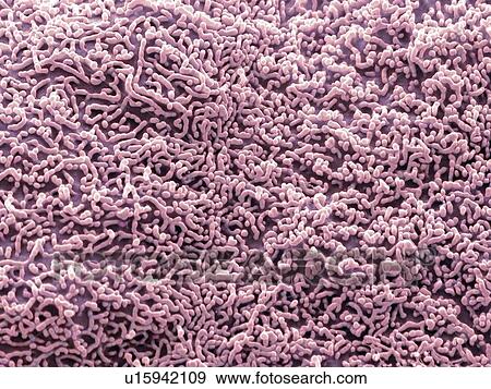 Stock Photo - Ureter lining. Coloured scanning electron micrograph (SEM) of the surface of a squamous epithelial cell from the ureter. Magnification: x6, 500 when printed at 10 centimetres wide.. Fotosearch