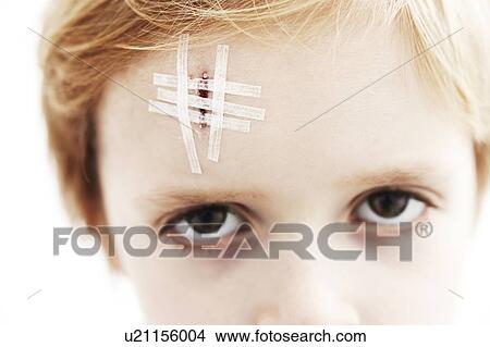 Picture - Young boy with head wound. The wound is closed with steri-strips.. Fotosearch