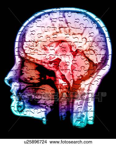 Conceptual image of human brain View Large Photo Image Picture - Conceptual image of human brain. Fotosearch