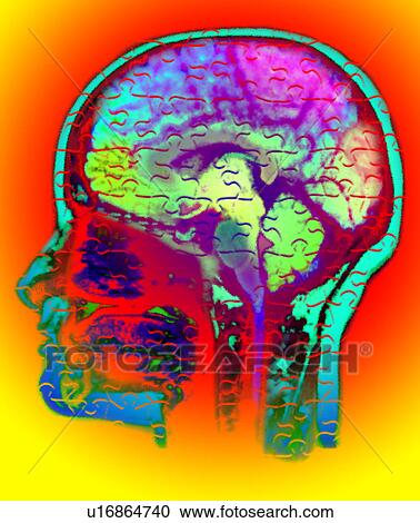 Conceptual image of human brain View Large Photo Image Stock Image - Conceptual image of human brain. Fotosearch