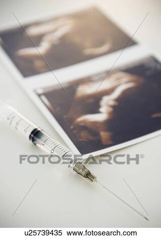Sonogram and syringe View Large Photo Image Stock Photography - Sonogram and syringe. Fotosearch