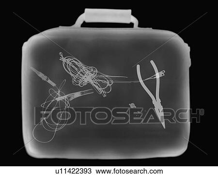 X-ray image showing briefcase containing suspect device View Large Photo Image Stock Image - X-ray image showing briefcase containing suspect device. Fotosearch