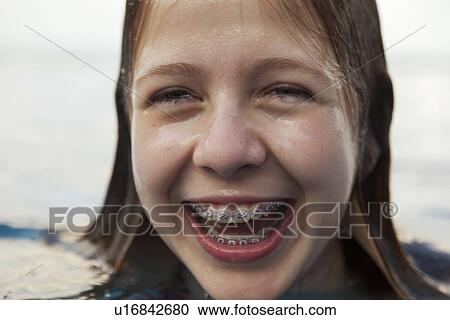 Stock Image - Smiling girl revealing braces. Fotosearch