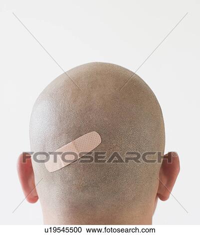 Back view of man with adhesive bandage on shaved head View Large Photo Image Stock Image - Back view of man with adhesive bandage on shaved head. Fotosearch