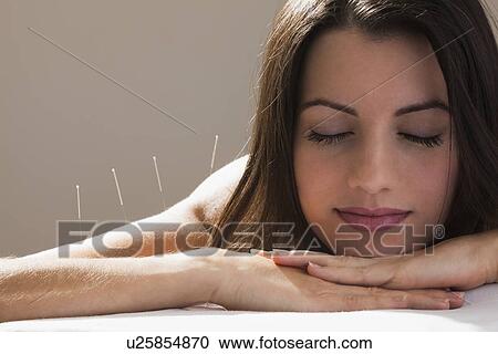 Close-up of woman with acupuncture needles in her arm and shoulders View Large Photo Image Stock Image - Close-up of woman with acupuncture needles in her arm and shoulders. Fotosearch