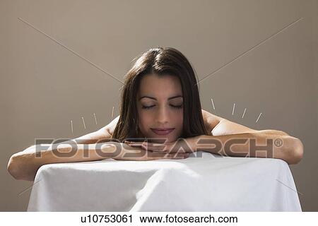 Woman laying on stomach with acupuncture needles in her shoulders View Large Photo Image Stock Image - Woman laying on stomach with acupuncture needles in her shoulders. Fotosearch