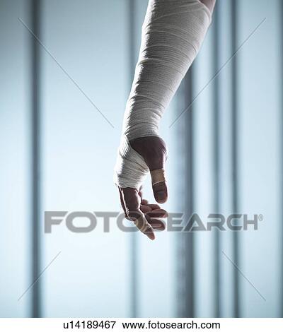 Stock Photo - Close up of hand covered in bandages. Fotosearch
