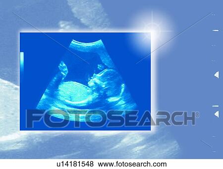 Stock Photo - 20-week baby scan. Fotosearch